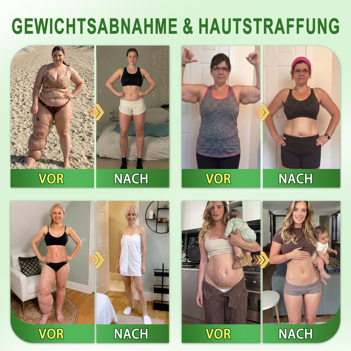 Offizieller Shop | 🍀 CareUplift® Stoffwechsel-Pflaster mit Braunalgenextrakt & Berberin | ✅ 1× täglich | 🔥 Unterstützt Fettabbau & natürliche Gewichtsabnahme