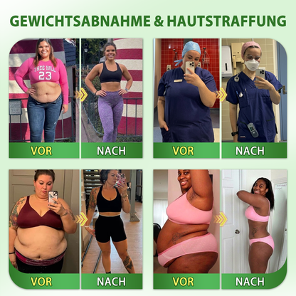 Offizieller Shop | 🍀 CareUplift® Stoffwechsel-Pflaster mit Braunalgenextrakt & Berberin | ✅ 1× täglich | 🔥 Unterstützt Fettabbau & natürliche Gewichtsabnahme